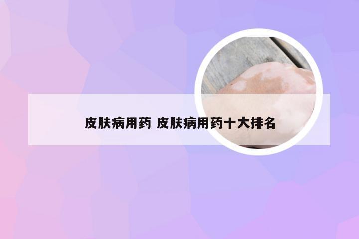 皮肤病用药 皮肤病用药十大排名