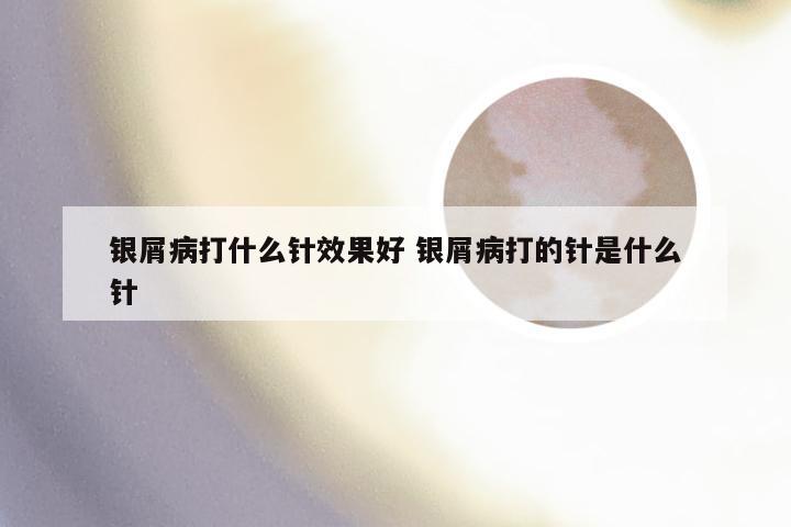 银屑病打什么针效果好 银屑病打的针是什么针