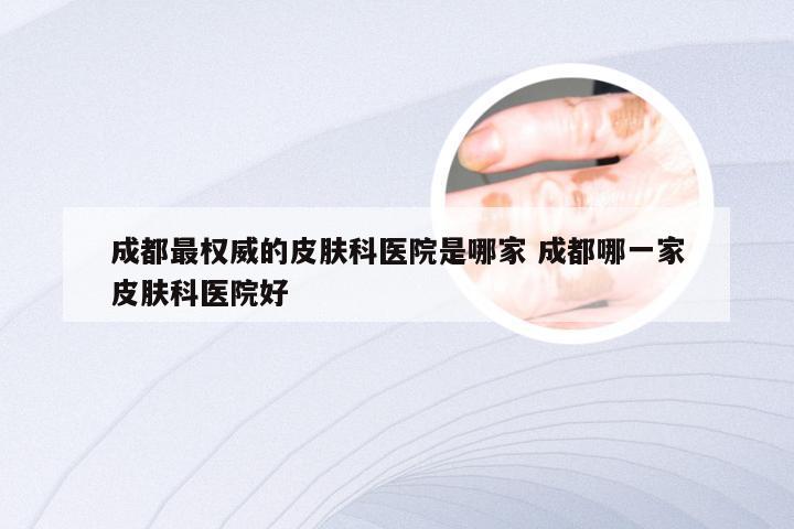成都最权威的皮肤科医院是哪家 成都哪一家皮肤科医院好