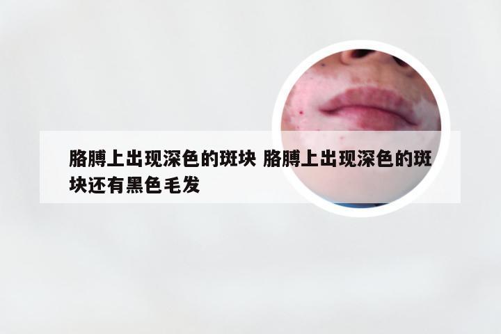 胳膊上出现深色的斑块 胳膊上出现深色的斑块还有黑色毛发
