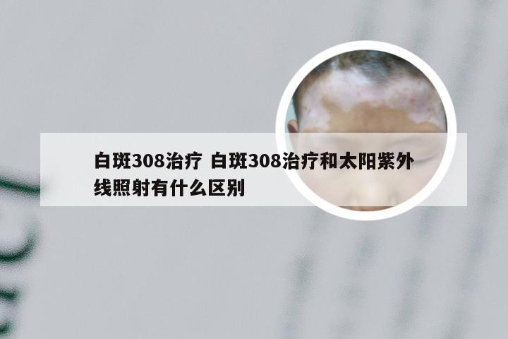 白斑308治疗 白斑308治疗和太阳紫外线照射有什么区别