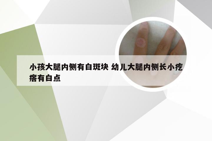 小孩大腿内侧有白斑块 幼儿大腿内侧长小疙瘩有白点