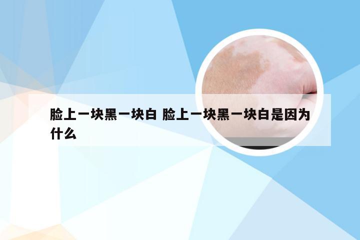 脸上一块黑一块白 脸上一块黑一块白是因为什么