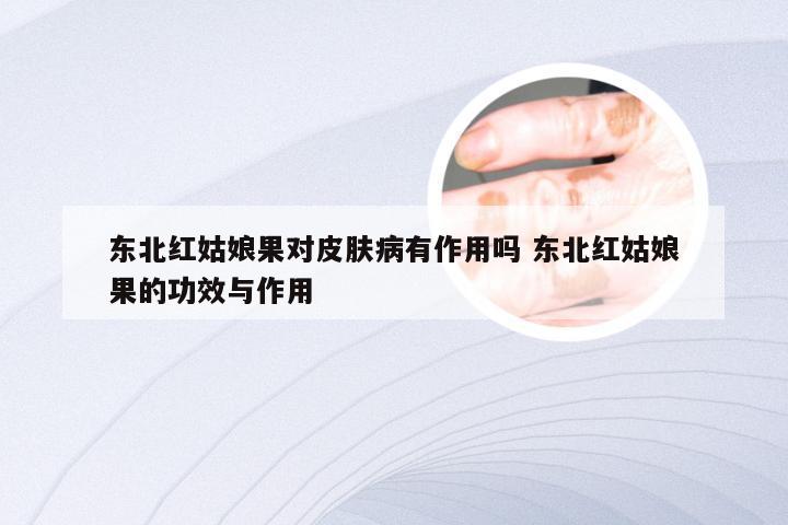 东北红姑娘果对皮肤病有作用吗 东北红姑娘果的功效与作用