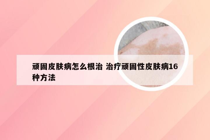 顽固皮肤病怎么根治 治疗顽固性皮肤病16种方法