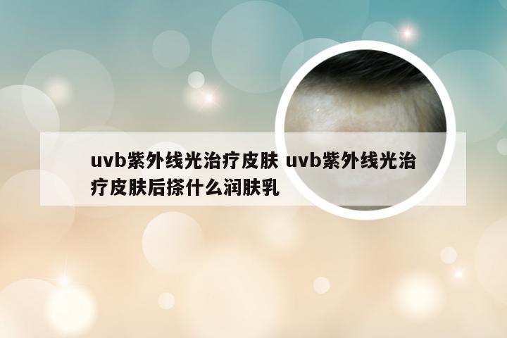 uvb紫外线光治疗皮肤 uvb紫外线光治疗皮肤后搽什么润肤乳