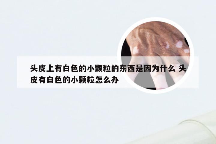 头皮上有白色的小颗粒的东西是因为什么 头皮有白色的小颗粒怎么办