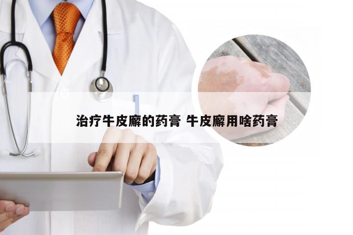 治疗牛皮廨的药膏 牛皮廨用啥药膏