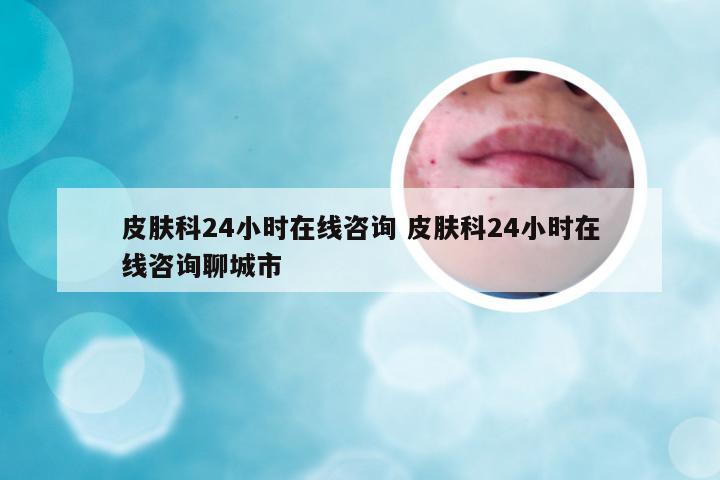 皮肤科24小时在线咨询 皮肤科24小时在线咨询聊城市