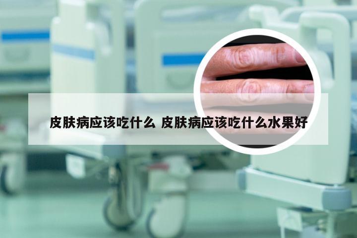 皮肤病应该吃什么 皮肤病应该吃什么水果好
