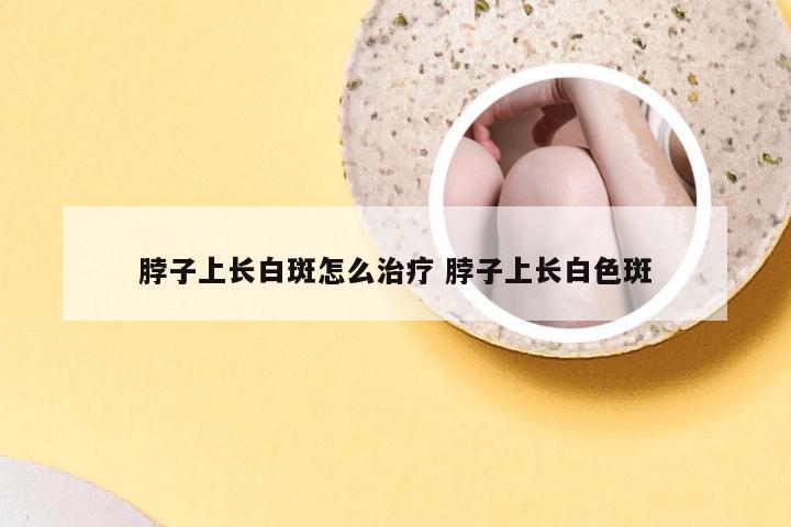 脖子上长白斑怎么治疗 脖子上长白色斑
