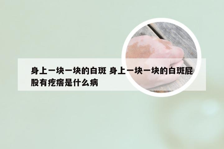 身上一块一块的白斑 身上一块一块的白斑屁股有疙瘩是什么病