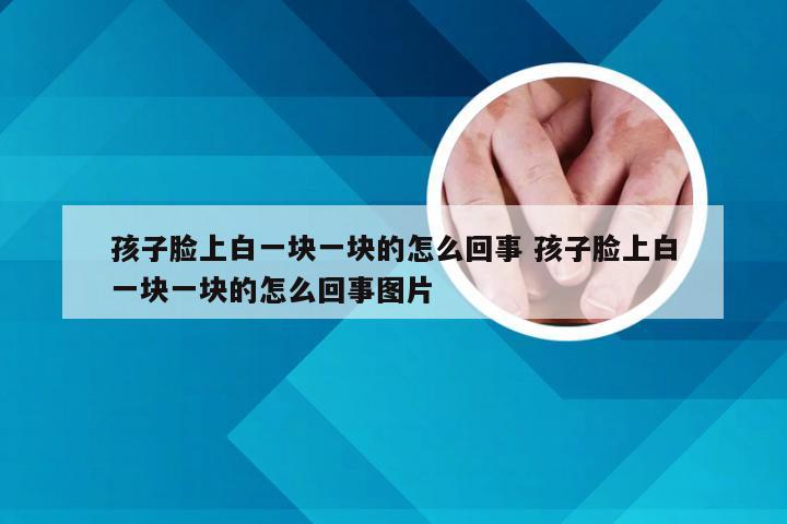 孩子脸上白一块一块的怎么回事 孩子脸上白一块一块的怎么回事图片