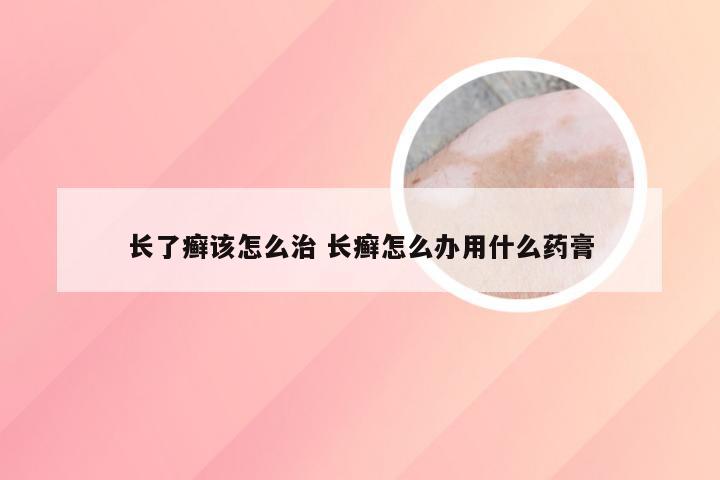 长了癣该怎么治 长癣怎么办用什么药膏