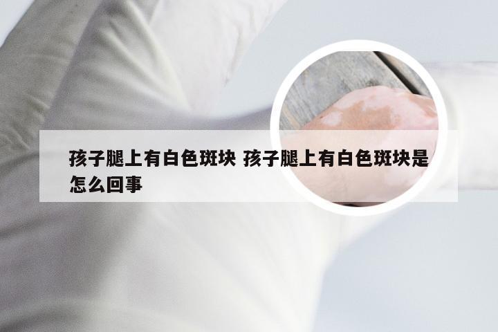 孩子腿上有白色斑块 孩子腿上有白色斑块是怎么回事