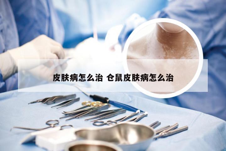 皮肤病怎么治 仓鼠皮肤病怎么治