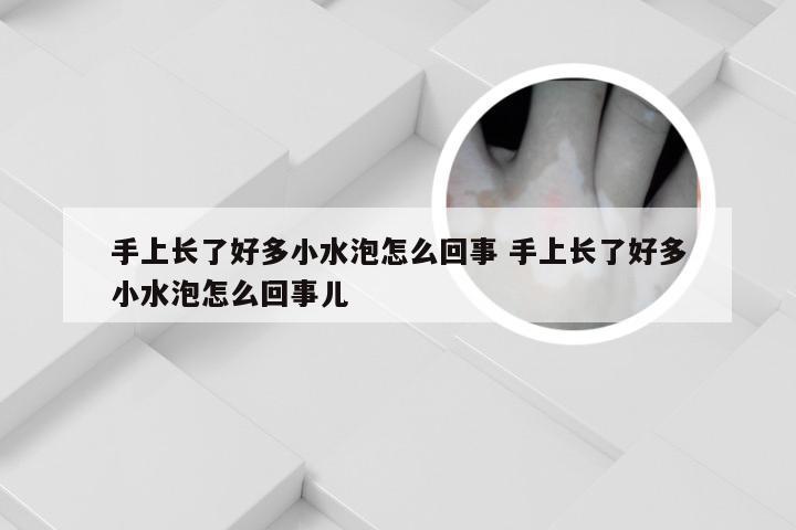 手上长了好多小水泡怎么回事 手上长了好多小水泡怎么回事儿