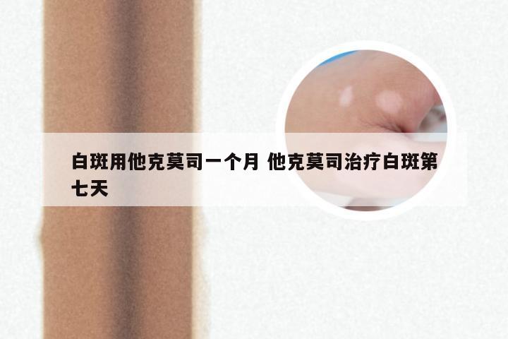 白斑用他克莫司一个月 他克莫司治疗白斑第七天