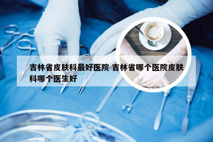 吉林省皮肤科最好医院 吉林省哪个医院皮肤科哪个医生好