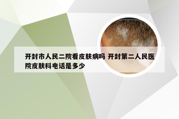 开封市人民二院看皮肤病吗 开封第二人民医院皮肤科电话是多少