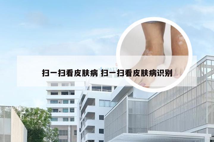 扫一扫看皮肤病 扫一扫看皮肤病识别