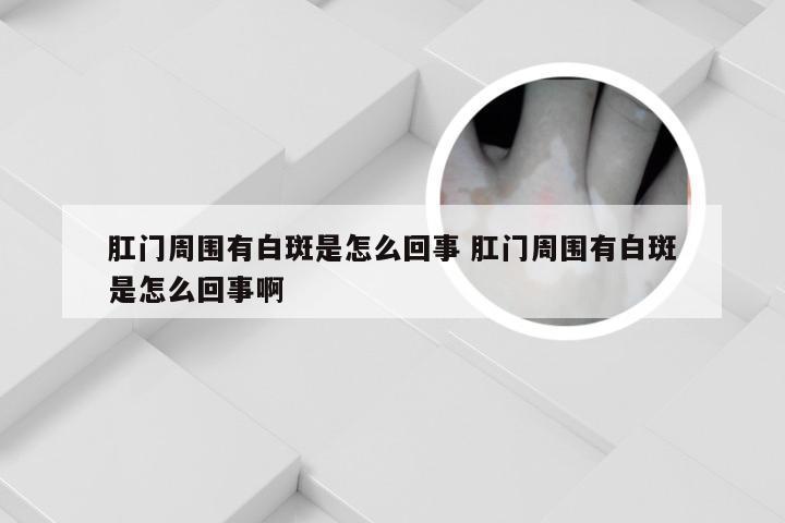 肛门周围有白斑是怎么回事 肛门周围有白斑是怎么回事啊