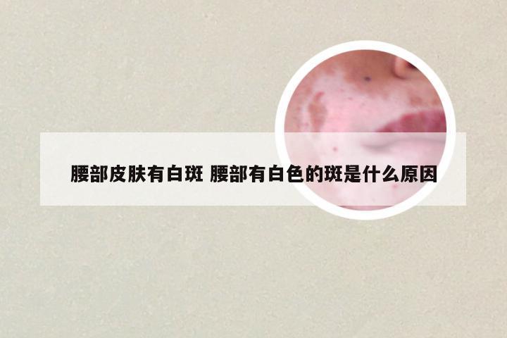 腰部皮肤有白斑 腰部有白色的斑是什么原因