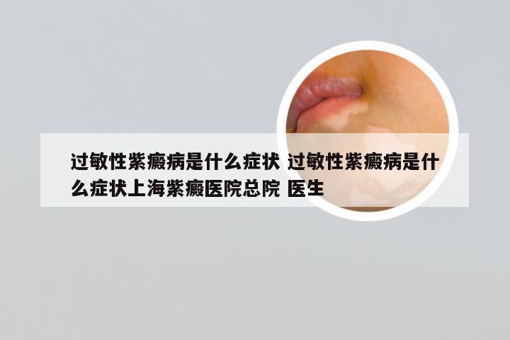 过敏性紫癜病是什么症状 过敏性紫癜病是什么症状上海紫癜医院总院 医生