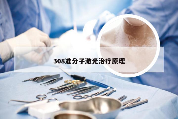 308准分子激光治疗原理