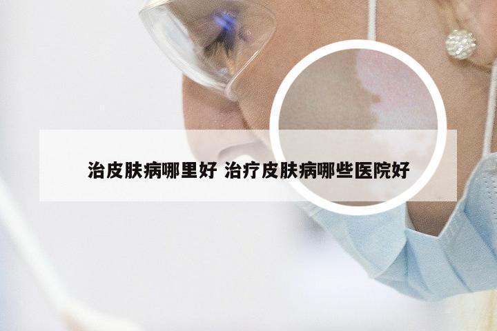 治皮肤病哪里好 治疗皮肤病哪些医院好