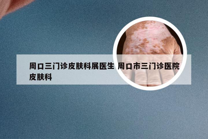 周口三门诊皮肤科展医生 周口市三门诊医院皮肤科