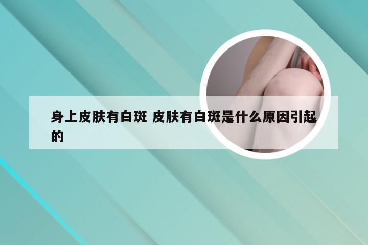 身上皮肤有白斑 皮肤有白斑是什么原因引起的