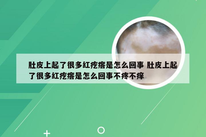肚皮上起了很多红疙瘩是怎么回事 肚皮上起了很多红疙瘩是怎么回事不疼不痒