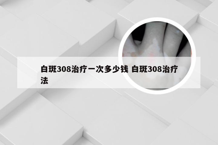 白斑308治疗一次多少钱 白斑308治疗法