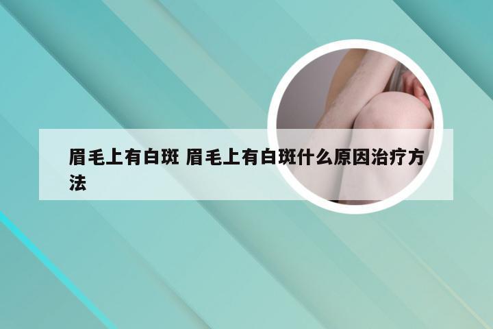 眉毛上有白斑 眉毛上有白斑什么原因治疗方法