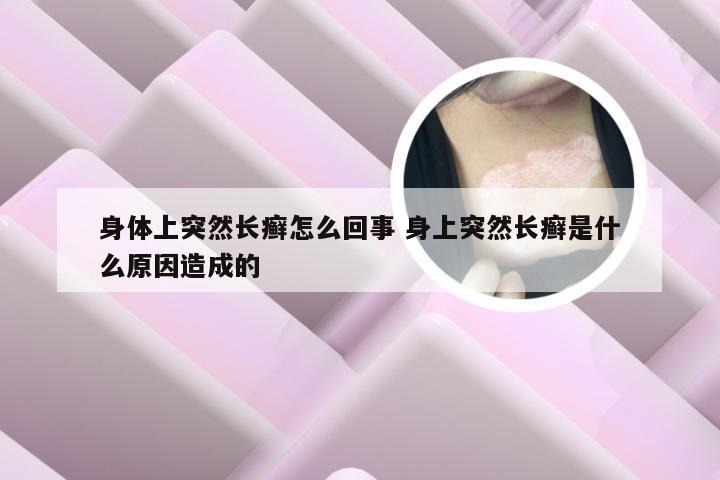 身体上突然长癣怎么回事 身上突然长癣是什么原因造成的