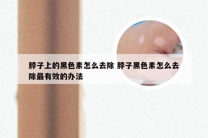 脖子上的黑色素怎么去除 脖子黑色素怎么去除最有效的办法