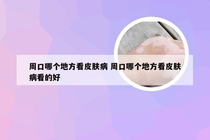 周口哪个地方看皮肤病 周口哪个地方看皮肤病看的好