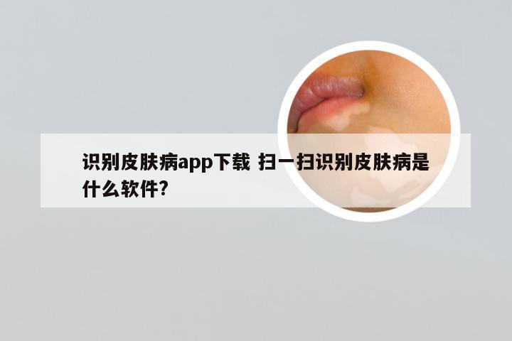 识别皮肤病app下载 扫一扫识别皮肤病是什么软件?