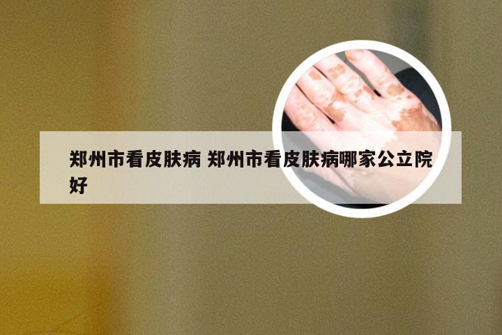 郑州市看皮肤病 郑州市看皮肤病哪家公立院好