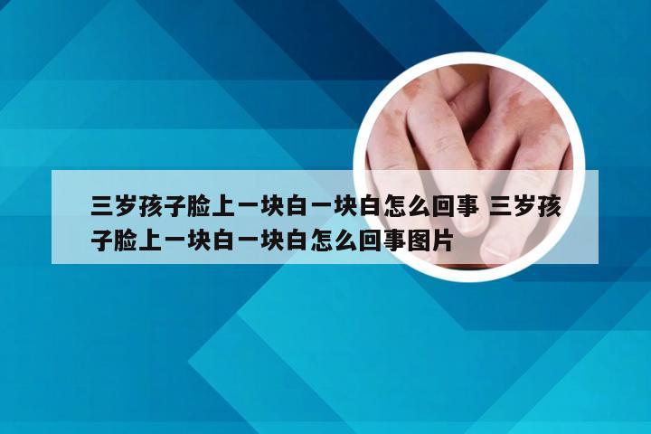 三岁孩子脸上一块白一块白怎么回事 三岁孩子脸上一块白一块白怎么回事图片