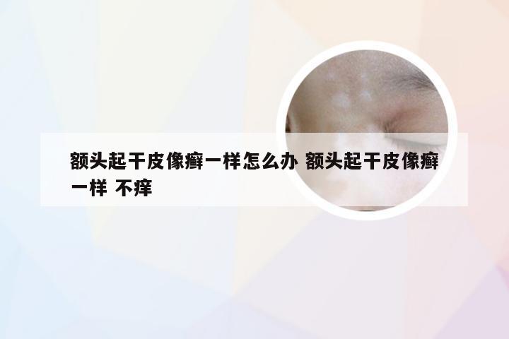 额头起干皮像癣一样怎么办 额头起干皮像癣一样 不痒