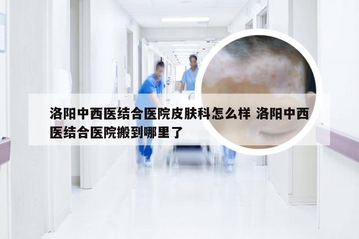 洛阳中西医结合医院皮肤科怎么样 洛阳中西医结合医院搬到哪里了