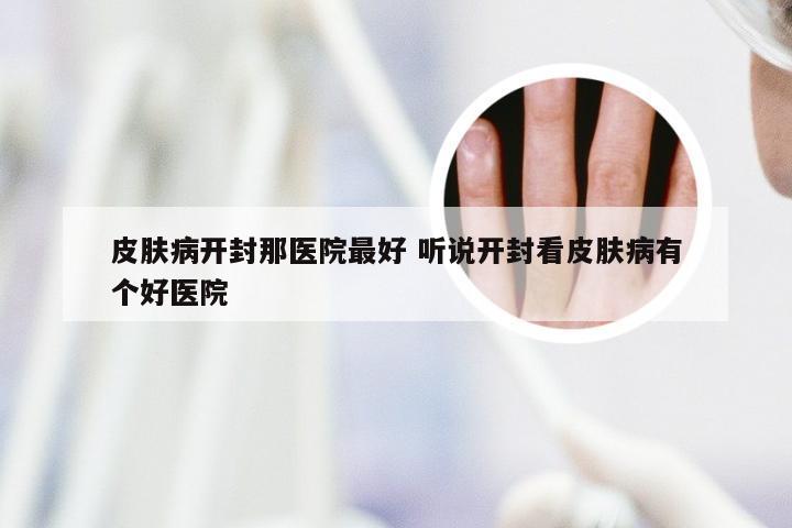 皮肤病开封那医院最好 听说开封看皮肤病有个好医院