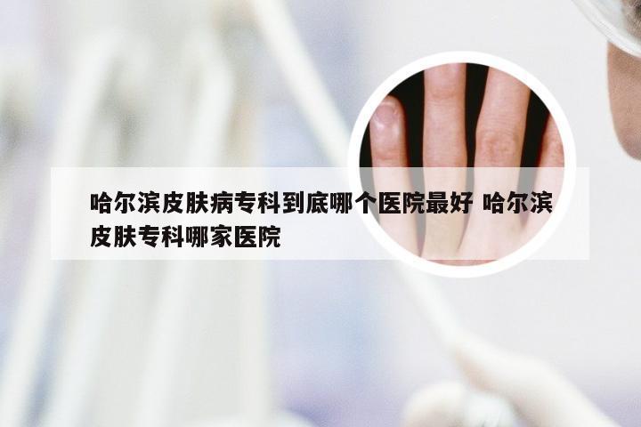 哈尔滨皮肤病专科到底哪个医院最好 哈尔滨皮肤专科哪家医院