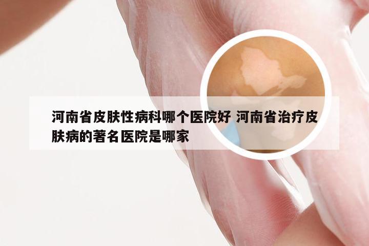 河南省皮肤性病科哪个医院好 河南省治疗皮肤病的著名医院是哪家