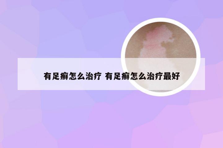 有足癣怎么治疗 有足癣怎么治疗最好