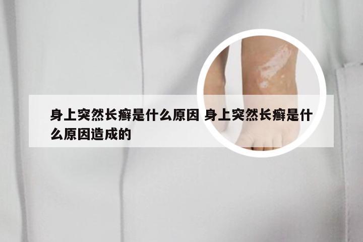 身上突然长癣是什么原因 身上突然长癣是什么原因造成的