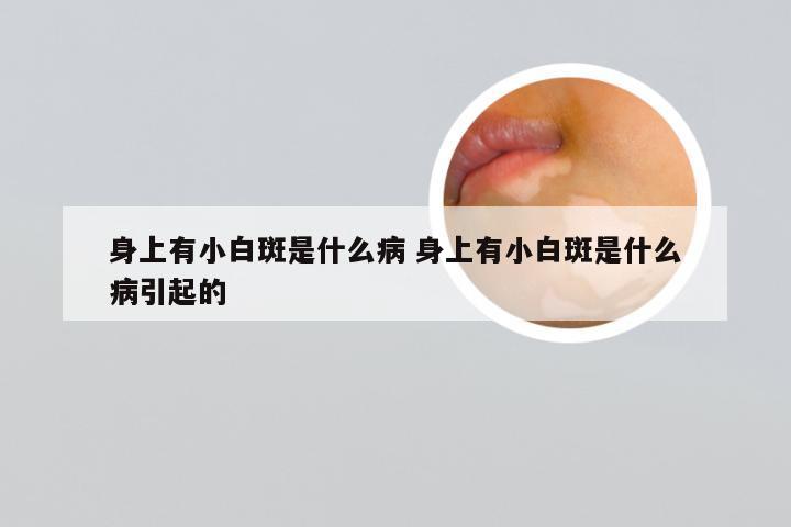 身上有小白斑是什么病 身上有小白斑是什么病引起的