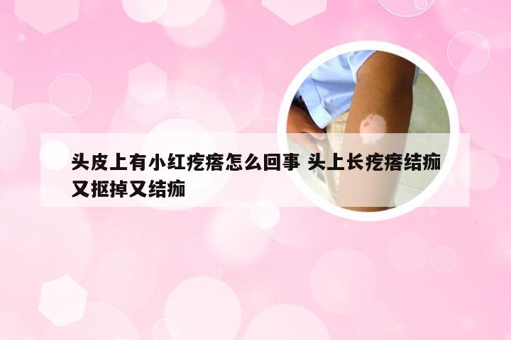 头皮上有小红疙瘩怎么回事 头上长疙瘩结痂又抠掉又结痂